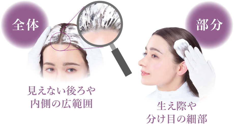 見えない後ろや内側の広範囲 生え際や分け目の細部